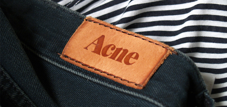 Acne